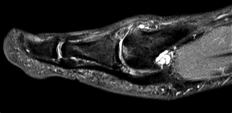 Foot and Ankle imaging | Philips MR Body Map