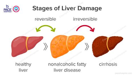 Non alcoholic fatty liver disease (NAFLD) - Causes and Symptoms
