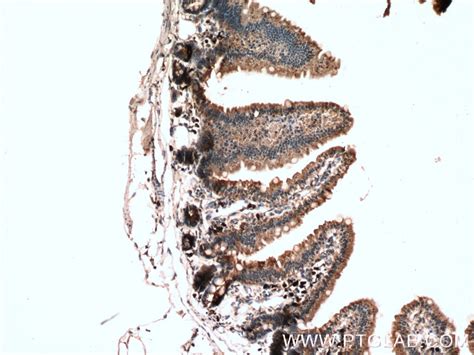 DFNA5/GSDME antibody (13075-1-AP) | Proteintech