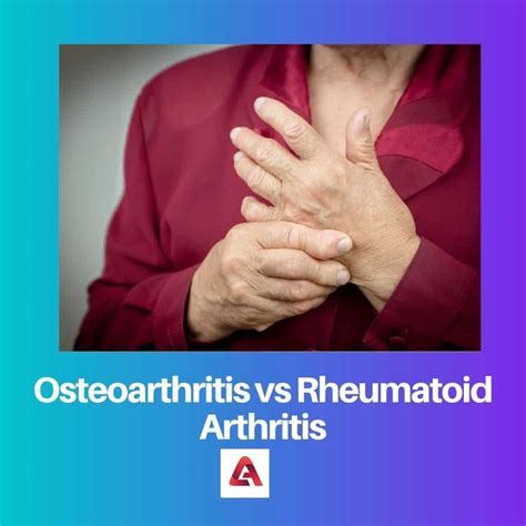 Osteoarthritis vs Rheumatoid Arthritis: Difference and Comparison