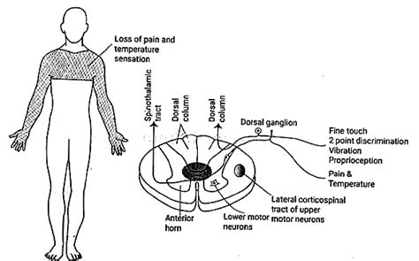 Basal Ganglia - Medical Science Optional Notes for UPSC PDF Download