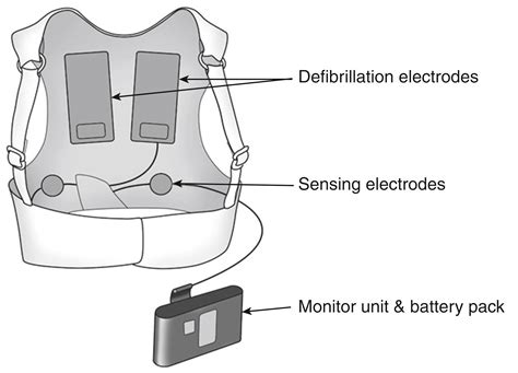 Wearable Defibrillators - Clinical Tree