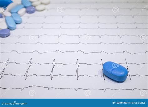 Electrocardiogram with Brugada Syndrome. Colored Pills on an EKG Path. Sudden Cardiac Death Due ...
