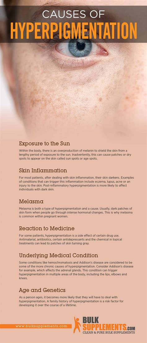 Hyperpigmentation