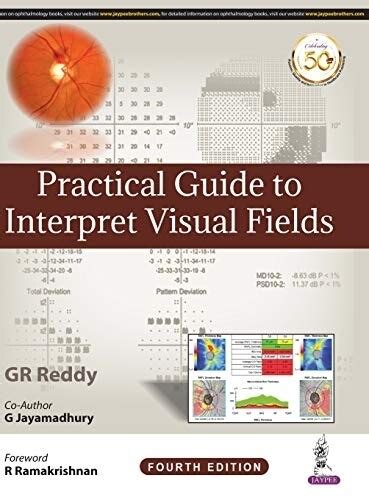 Image result for Check Visual Fields