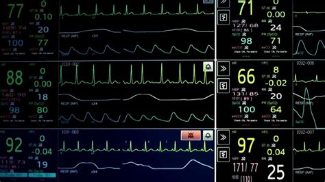 Image result for Telemetry Tech Test