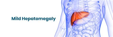 Understanding Mild Hepatomegaly