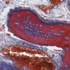 Image result for Bone Tissue Formation