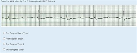 Image result for Pacemaker Programming