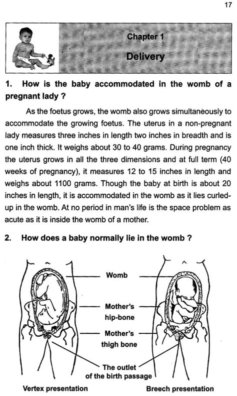 Baby Delivery Process 的图像结果
