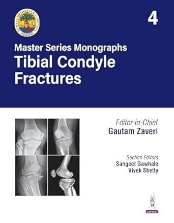 Buy BOS Master Series Monographs (Volume 4) Tibial Condyle Fractures ...