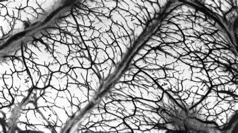 Image result for Frame Problem Explained