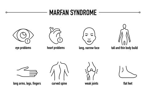 Marfan Syndrome Eyesight