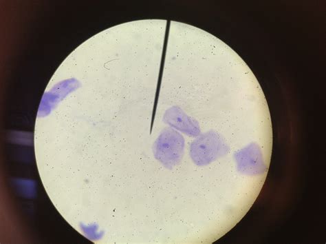 Cheek Cell Under Microscope
