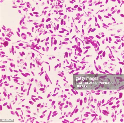 Acetobacter Isolation Process Image 的图像结果