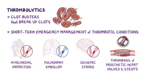 Thrombolytic Enzymes Examples at David Greenfield blog