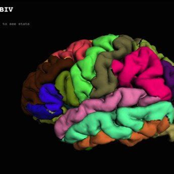 Master Visualization 的图像结果