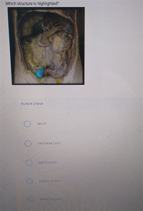 Solved Which structure is highlighted? Mutiple Cholce cecum | Chegg.com