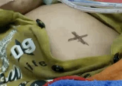 infant dies after branding with hot rod shaman burns nine month old ...