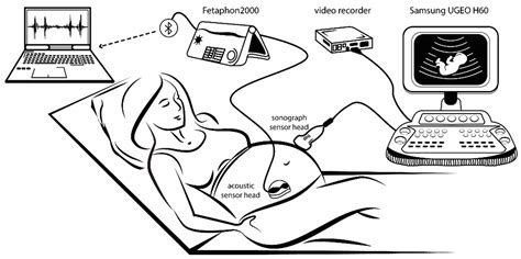 Novel Phonography-Based Measurement for Fetal Breathing Movement in the ...