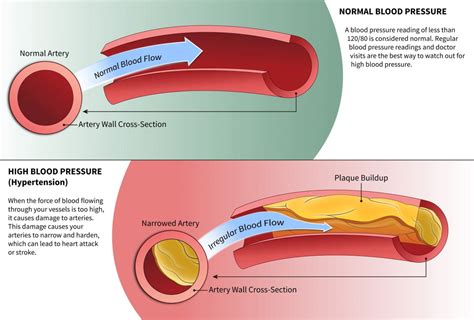 Image result for Ed Blood Flow Problems