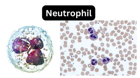 Neutrophils: Your Bodys Tiny Defenders