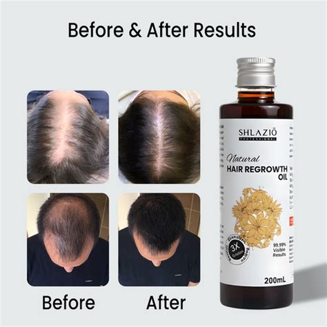 Shlazio Professional | Formulated with Care, Delivered with Elegance