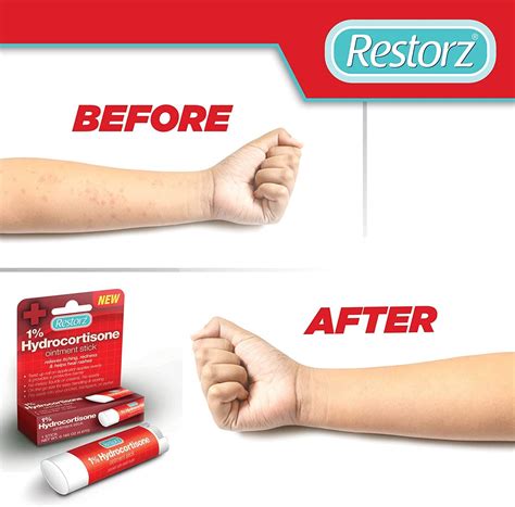 Cortisone For Rashes