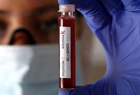 Coronavirus outbreak is a blessing in disguise for testing kits ...