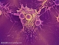 Image result for cytology 细胞病理