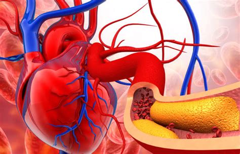 LDL Cholesterol: Importance, Normal Ranges & Management – MyDiagnostics