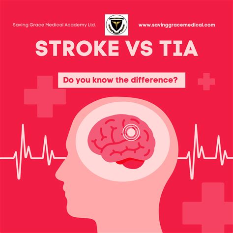 Understanding Stroke vs. TIA (Transient Ischemic Attack): Key Knowledge for Nursing Students