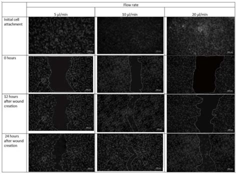 Fibroblast Derived Skin Wound Healing Modeling on Chip under the ...
