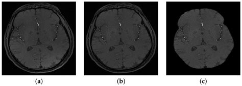 Using Mean Arterial Pressure in Hypertension Diagnosis versus Using ...