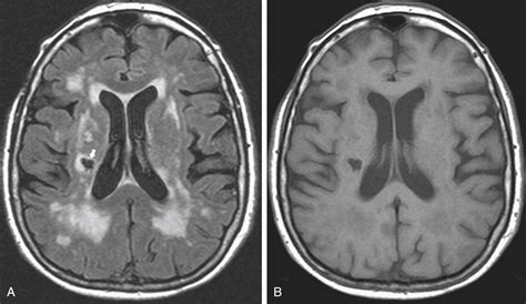 Structural Imaging Using Magnetic Resonance Imaging and Computed ...