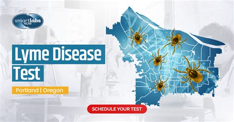 Lyme Disease Test - Portland | Oregon - Smart Labs Now | Lab Testing ...