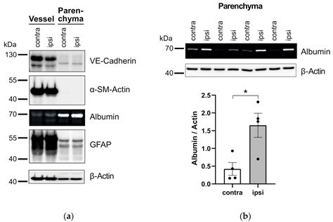 An Improved Method for Physical Separation of Cerebral Vasculature and ...