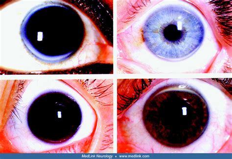 Image result for Iris Recognition Using MATLAB Source Code