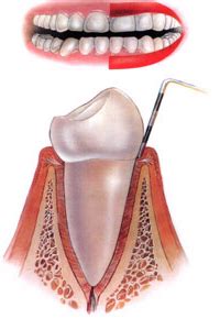 Pediatric Dentistry : Dentistry For Children : Dentistry For Children ...