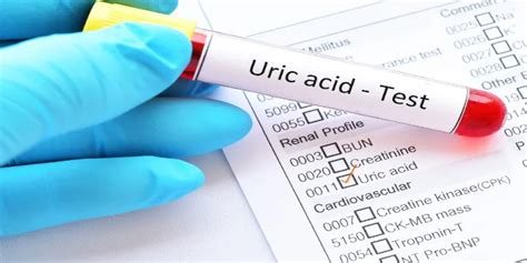 Uric Acid Test: Normal Range, High Vs. Low Levels In Blood