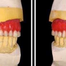 Image result for Contralateral Teeth