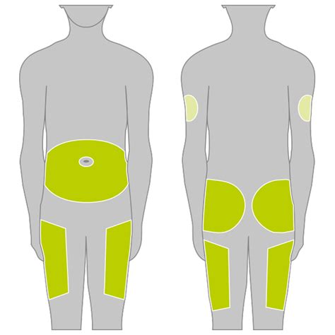 Abdomen Insulin Injection Sites Diagram at Mitchell Fredricksen blog