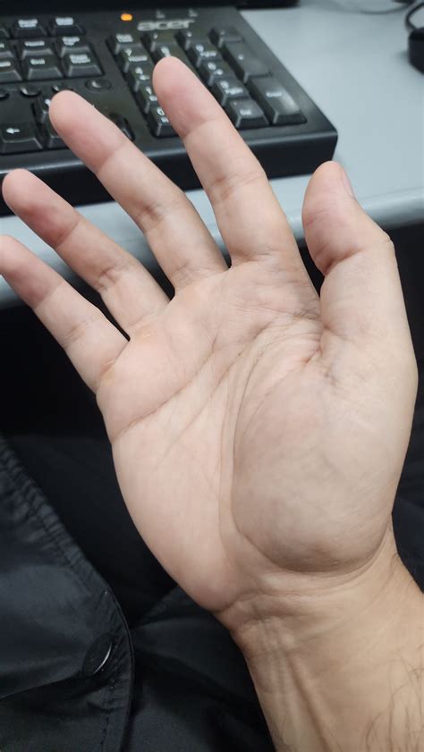 Image result for Normal Hand