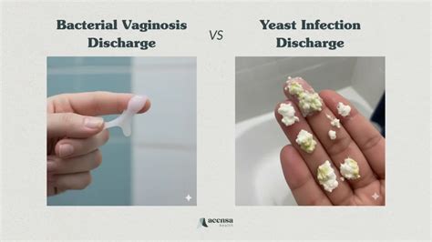 Bacterial Vaginosis vs Yeast Infection: Causes and Treatment