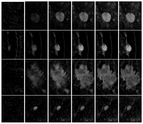 On Unsupervised Methods for Medical Image Segmentation: Investigating ...