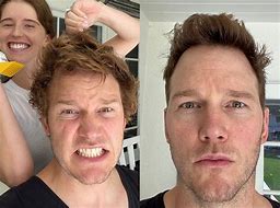 Image result for Chris Pratt and Hair Plug