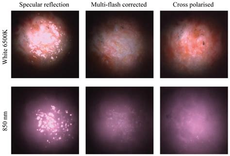 Microcamera Visualisation System to Overcome Specular Reflections for ...