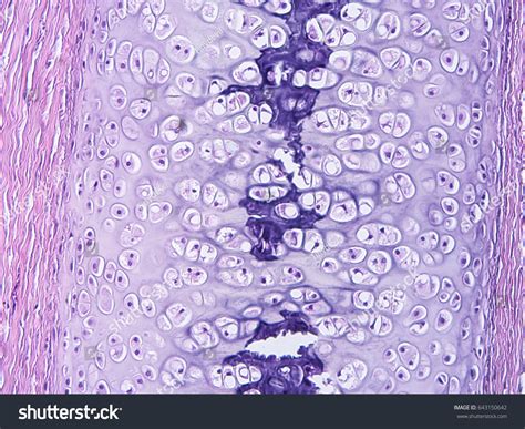 Elastic Cartilage Connective Tissue Labeled Elastic Cartilage