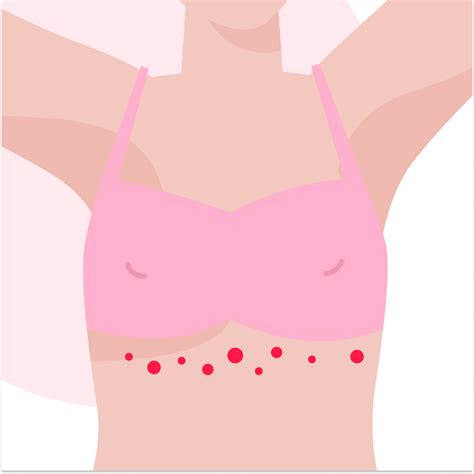 What Causes A Red Rash Under Your Breast - Design Talk