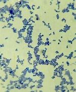 葡萄球菌 的图像结果